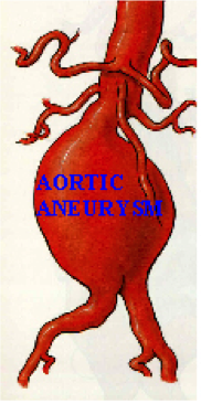 aorta